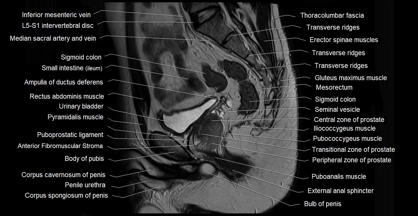 male pelvis sagittal cross sectional anatomy 3T mri image 21.webp